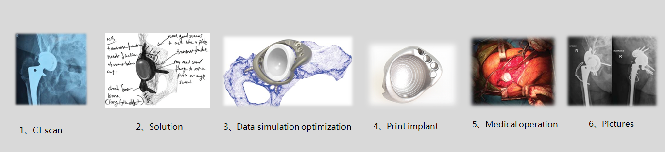 3D Printing Clinical Applications  . The Most Immediate Clinical Applications Of 3D Printing Are For Presurgical Planning, Intraoperative Guidance, And The Production Of Custom Implants.